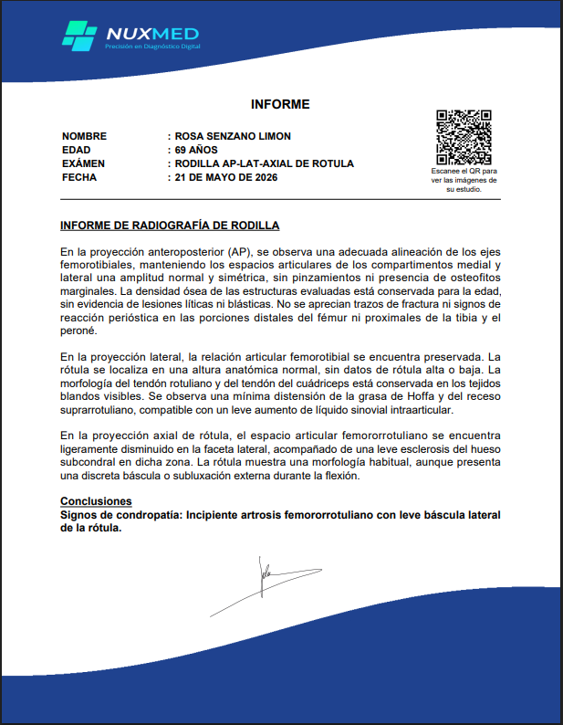 Plantilla y formato de informes en Nuxmed RIS PACS